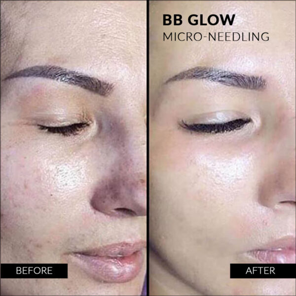 BB glow effects smooth skin, lifting effect, even skin tone, reductions of redness, pore reduction,reducing the dark circles under the eyes