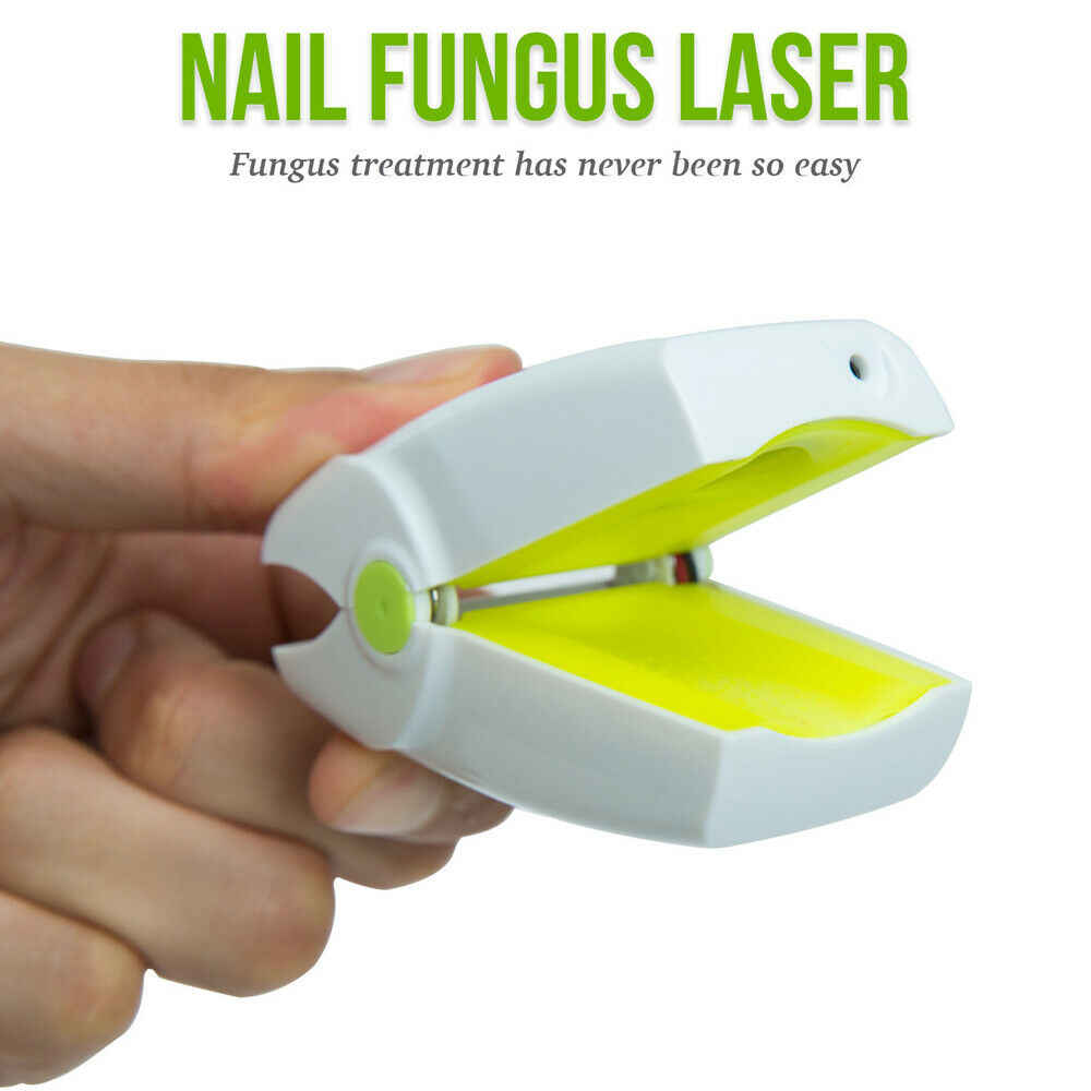 Anti Fungal Laser Device EX Nail Fungus Onychomycosis Laser Treatment  Instrument Low Level Laser LLLT Toenails Home Use No Pain - AliExpress